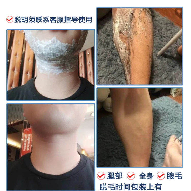 脱毛膏推荐男士快速脱胡子胡须胡渣胡青络腮胡温和脱毛胡子脱毛膏