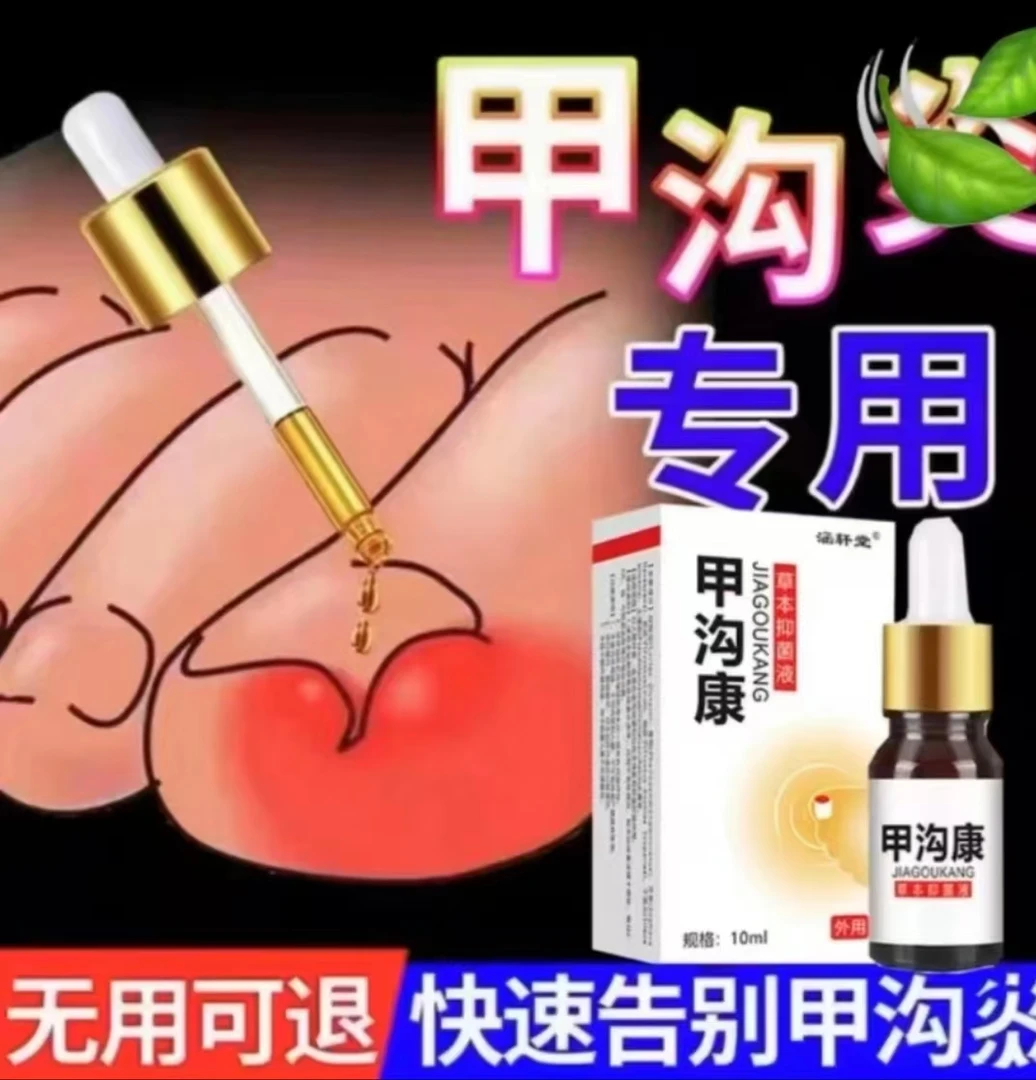 指甲长肉里甲沟软甲脱甲脚趾甲嵌甲肉芽脚指头疼甲沟草本护理膏