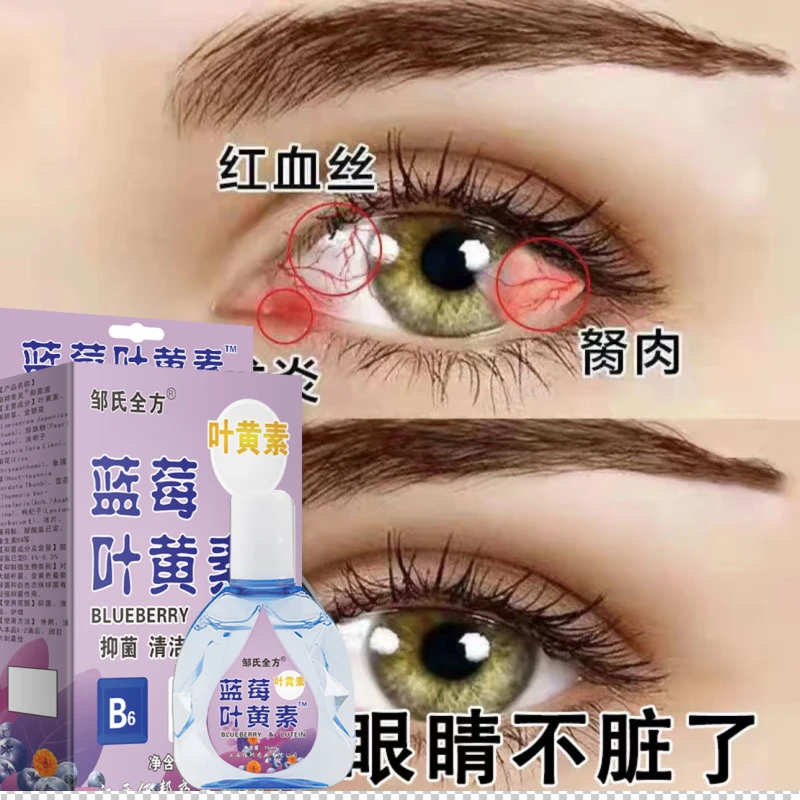 叶黄素滴眼液缓解疲劳干涩视线模糊红血丝迎风流泪护眼润眼滴眼水