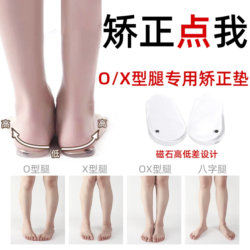 酷姿欣足弓矫正鞋垫o型腿xo型小腿外翻纠正腿型石护脚垫硅胶鞋垫