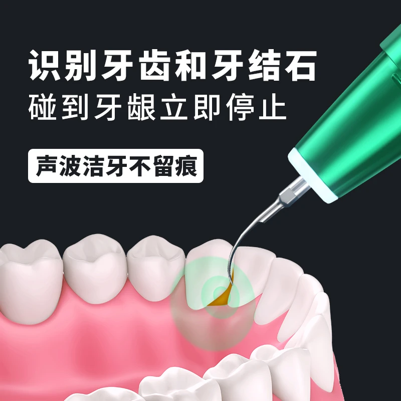 【不好用包退】真超声波电动洁牙器牙结石去除器洗牙齿污垢神器